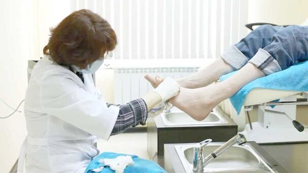 Dermatolog leczy grzybicę paznokci