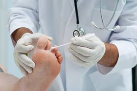 Przed leczeniem lekarz diagnozuje grzybicę paznokci